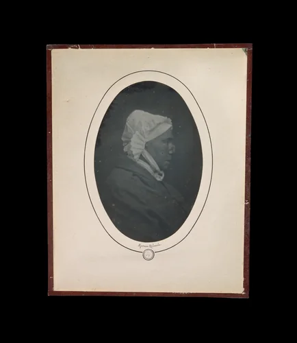 [Profile of a Woman with Necrosis of the Nose] by Louis-Auguste Bisson, photograph, 1841-1848