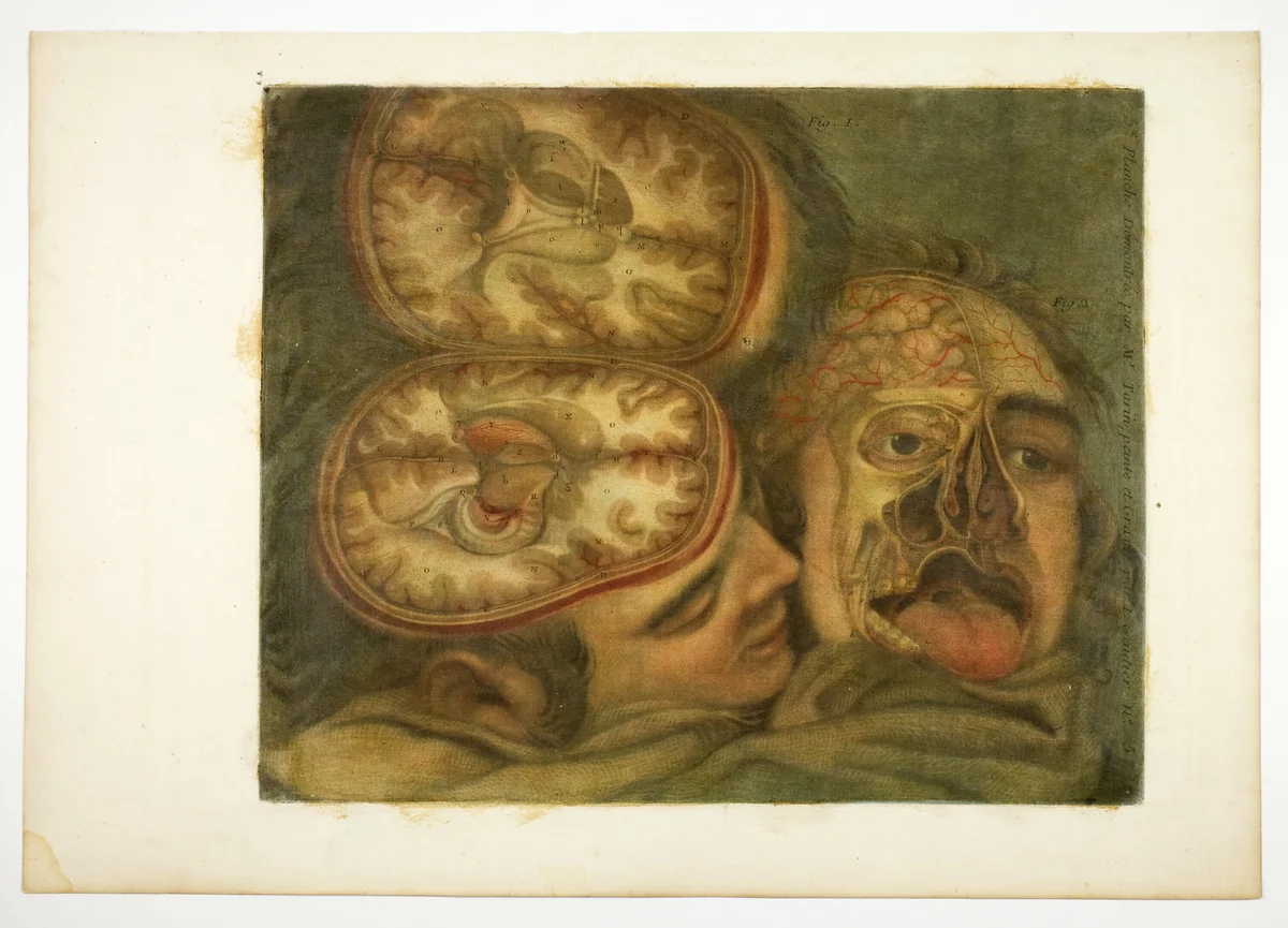 Cranial Dissection, plate five from Anatomy of the Head, in Printed Paintings by Jacques Fabien Gautier D'Agoty, print, 1748
