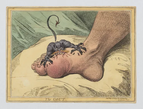 The Gout by James Gillray, print, 1799