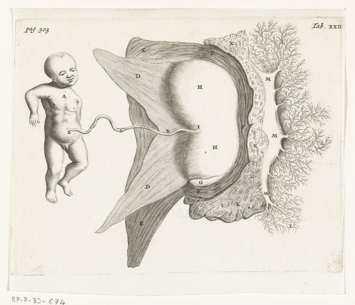 A foetus attached by the placenta to the womb by Hendrik Bary, print, 1672
