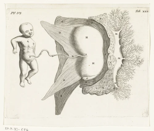 A foetus attached by the placenta to the womb by Hendrik Bary, print, 1672