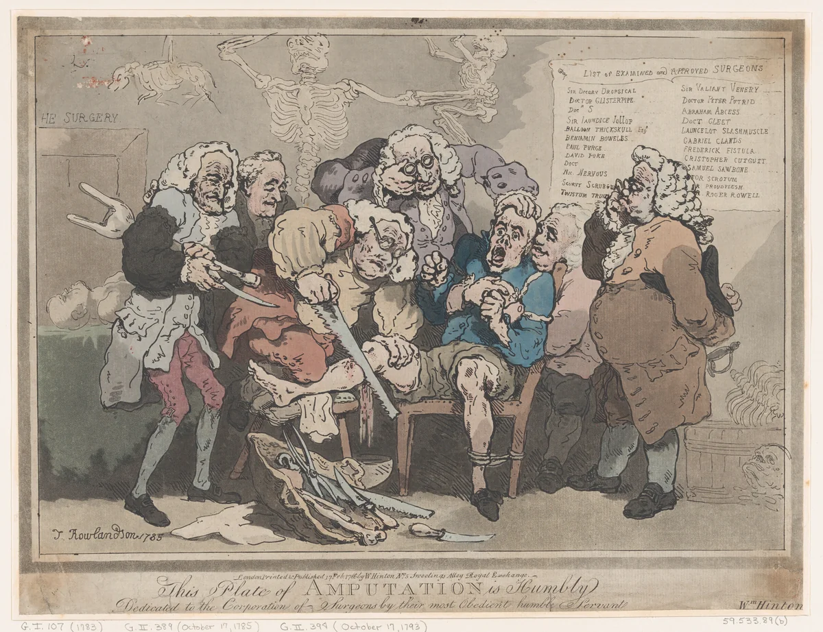 Amputation by Thomas Rowlandson, print, 1786