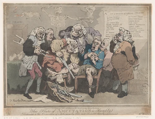 Amputation by Thomas Rowlandson, print, 1786