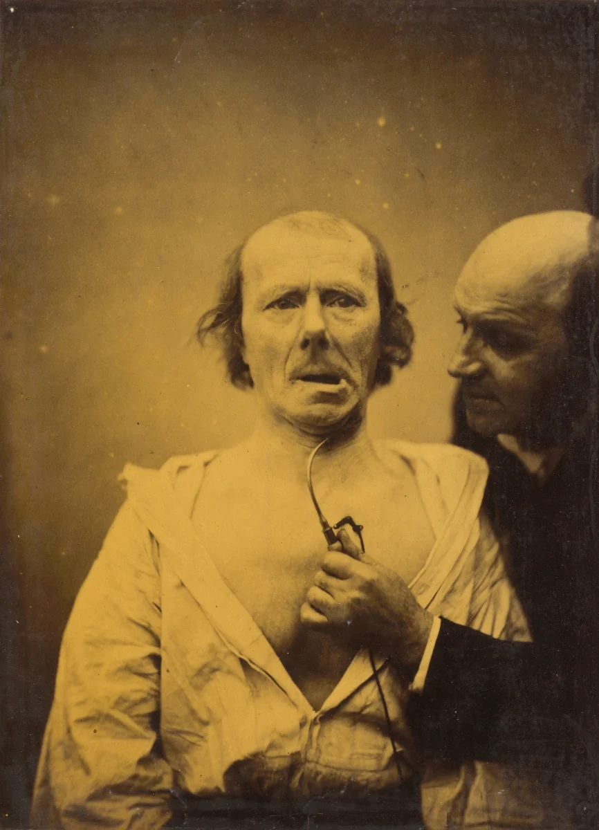 This contraction of m. platysma alone lacks expression by Guillaume-Benjamin-Amant Duchenne, photograph, 1854-1856