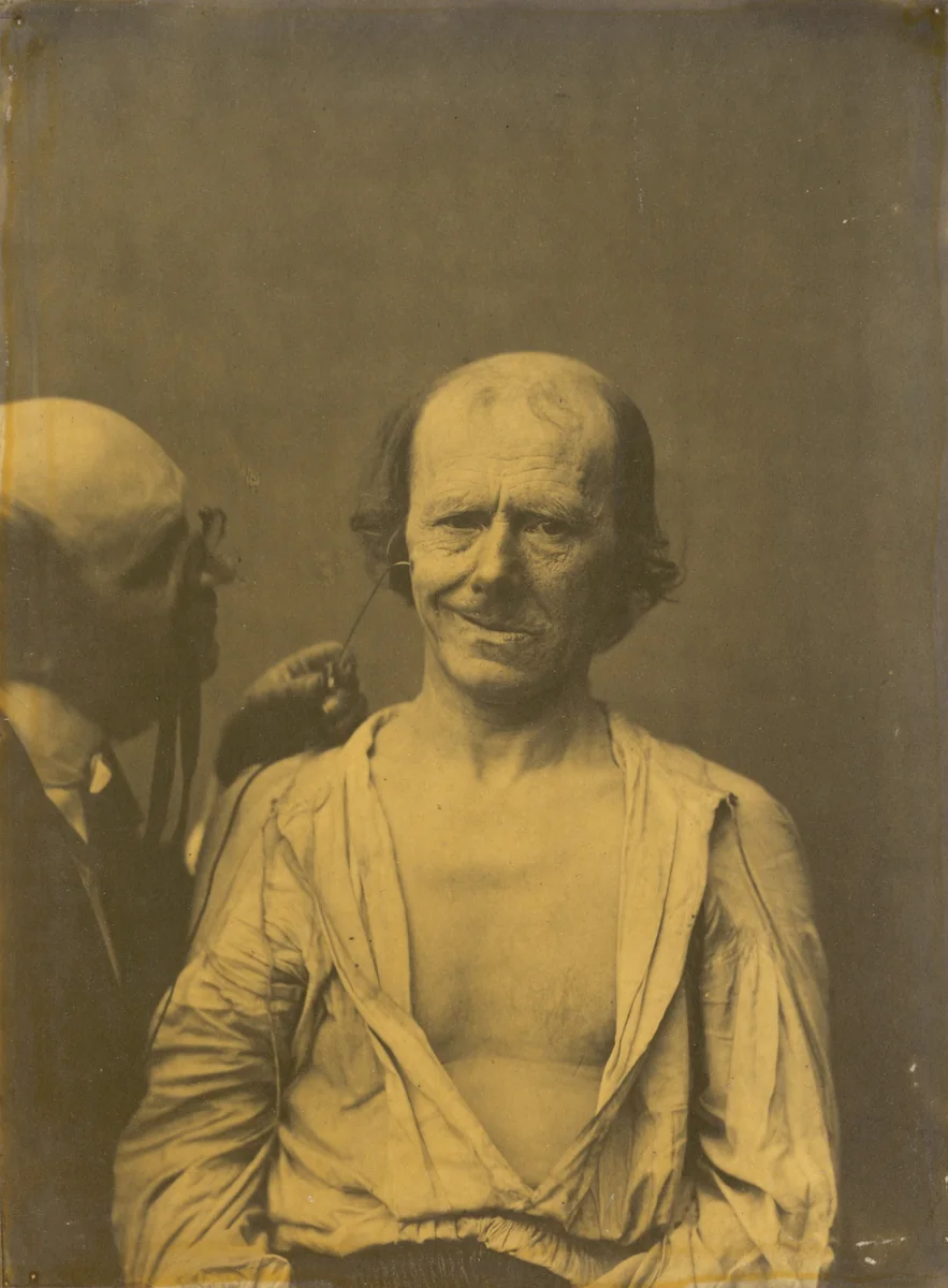 A relaxed face (left); False joy or laughter (right) by Guillaume-Benjamin-Amant Duchenne, photograph, 1854-1856
