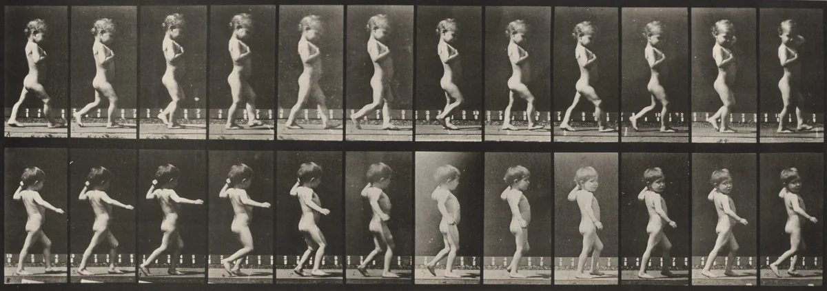 Plate Number 540. A: Bowlegs, boy. B: Spinal caries, girl walking by Eadweard Muybridge, photograph, 1887