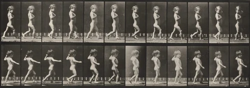 Plate Number 540. A: Bowlegs, boy. B: Spinal caries, girl walking by Eadweard Muybridge, photograph, 1887