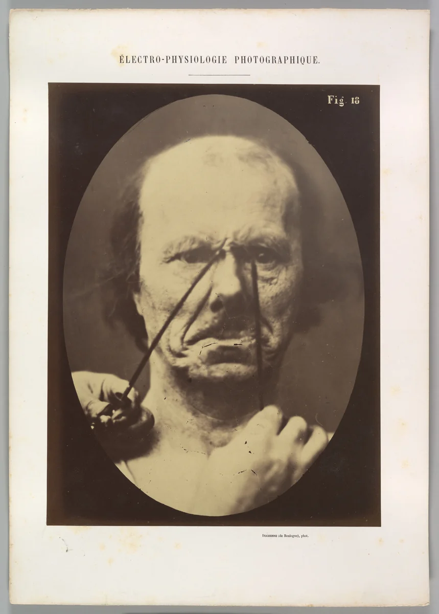 Figure 18: Aggression, wickedness by Guillaume Benjamin Amand Duchenne de Boulogne, photograph, 1854-1856