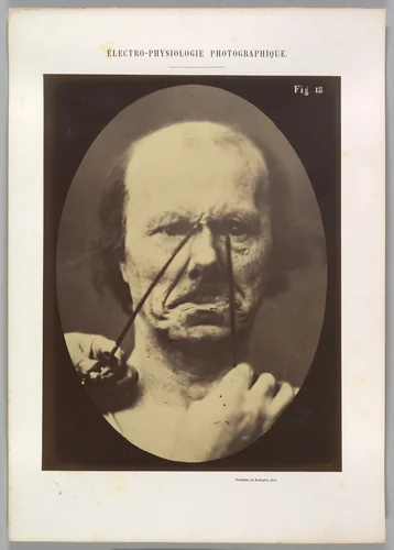 Figure 18: Aggression, wickedness by Guillaume Benjamin Amand Duchenne de Boulogne, photograph, 1854-1856