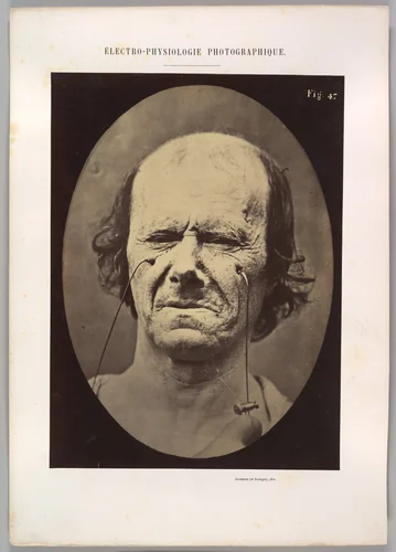 Figure 47: A suggestion of this same weeping by Guillaume Benjamin Amand Duchenne de Boulogne, photograph, 1854-1856