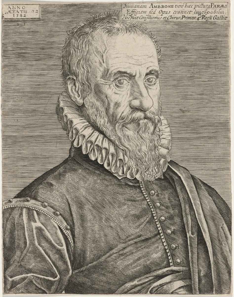 Ambrosius Parens by Unknown 19th Century, print, 1582