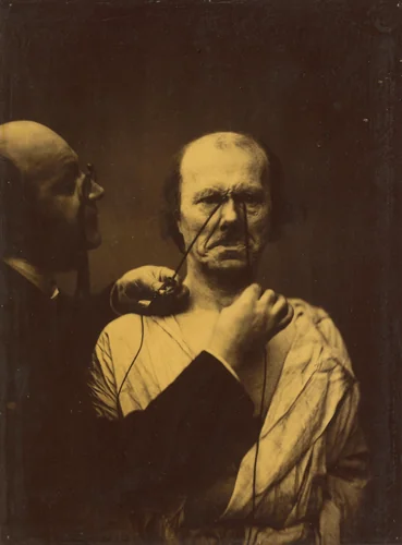 Aggression, wickedness by Guillaume-Benjamin-Amant Duchenne, photograph, 1854-1856