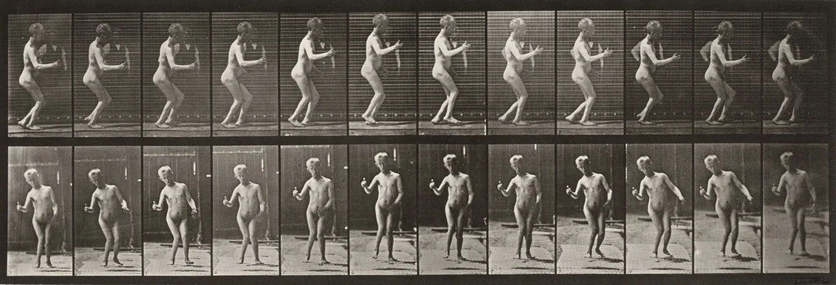 Plate Number 561. Hydrocephalus, walking by Eadweard Muybridge, photograph, 1887