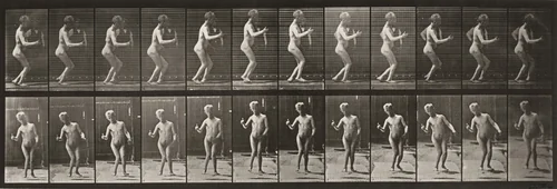 Plate Number 561. Hydrocephalus, walking by Eadweard Muybridge, photograph, 1887