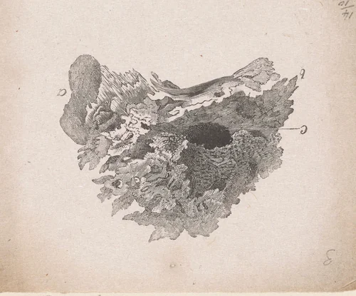 Onderdeel van het menselijk lichaam met een afwijking by Isaac Weissenbruch, print, 1836-1912