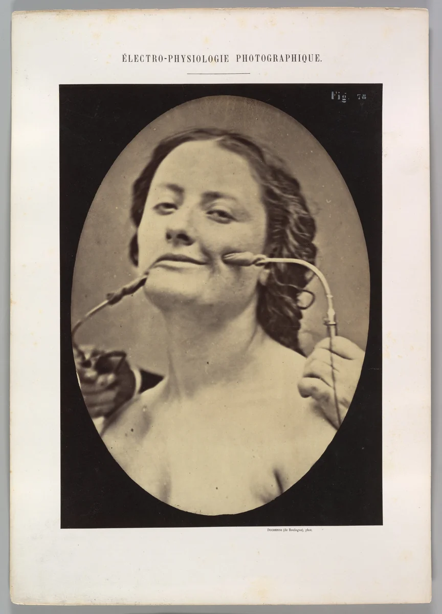 Figure 78: Scene of coquetry by Guillaume Benjamin Amand Duchenne de Boulogne, photograph, 1854-1856