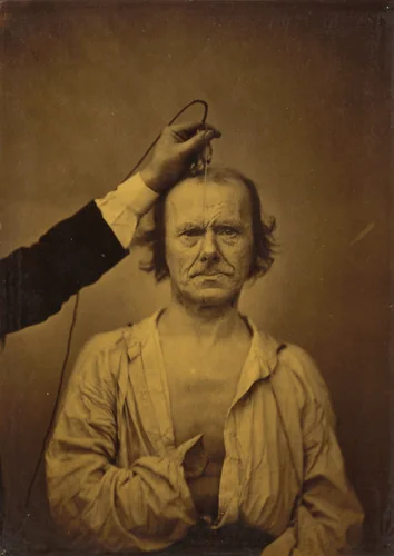 Attention (left); Severity, aggression (right) by Guillaume-Benjamin-Amant Duchenne, photograph, 1854-1856