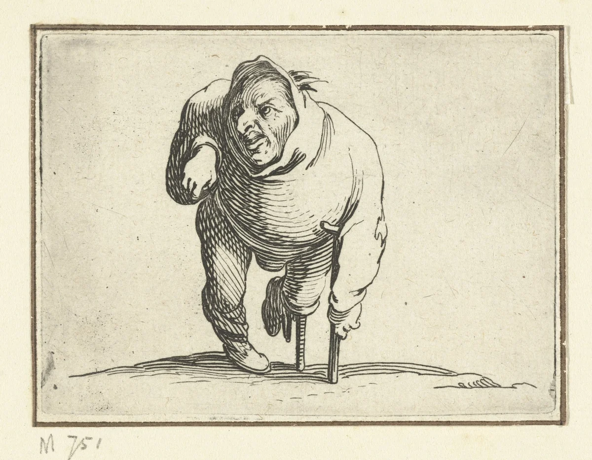 Kleine mens (karikatuur) met kruk en beensteun by Jacques Callot, print, 1621-1625