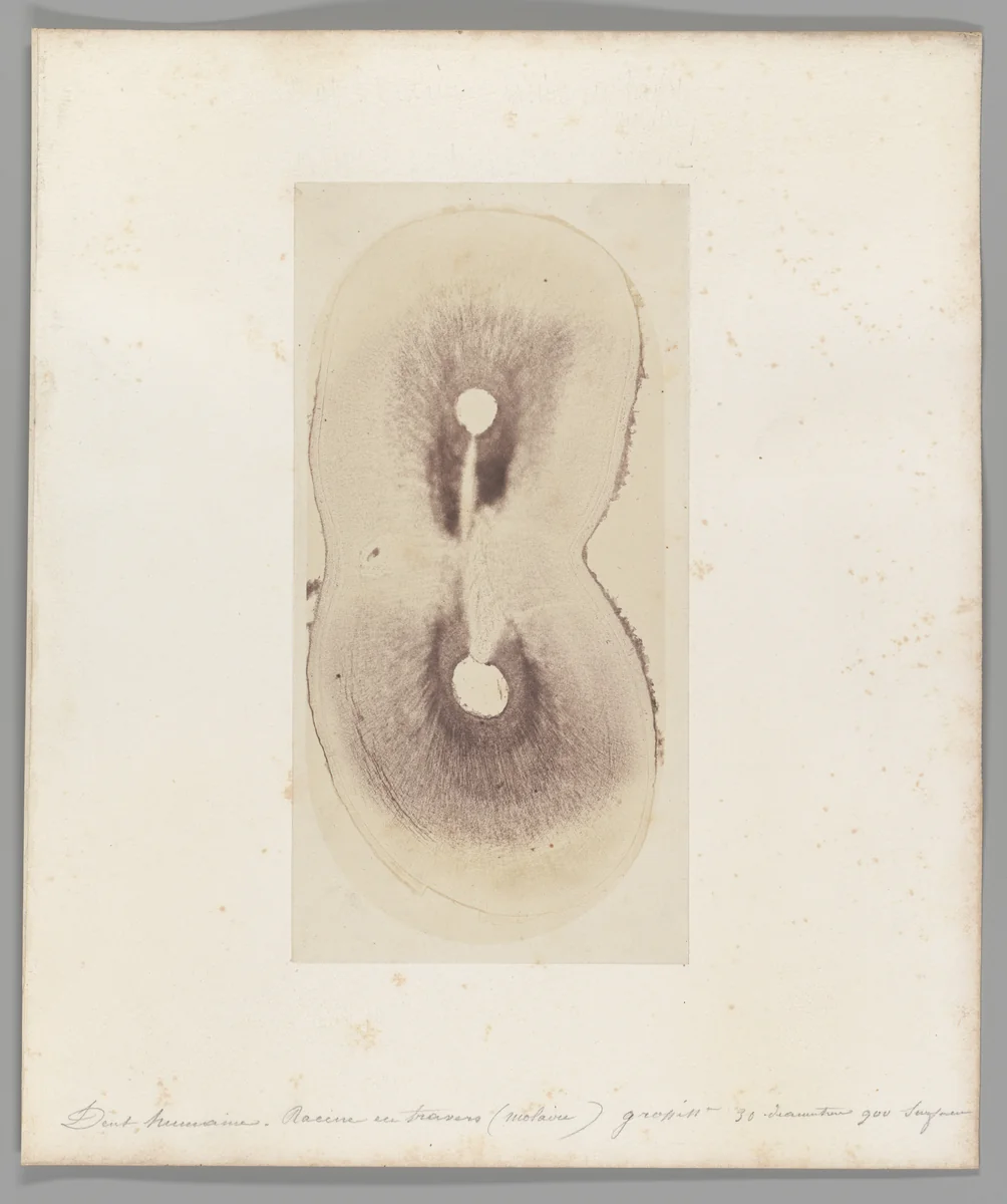 [Untitled] by Auguste-Adolphe Bertsch, photograph, 1853-1857