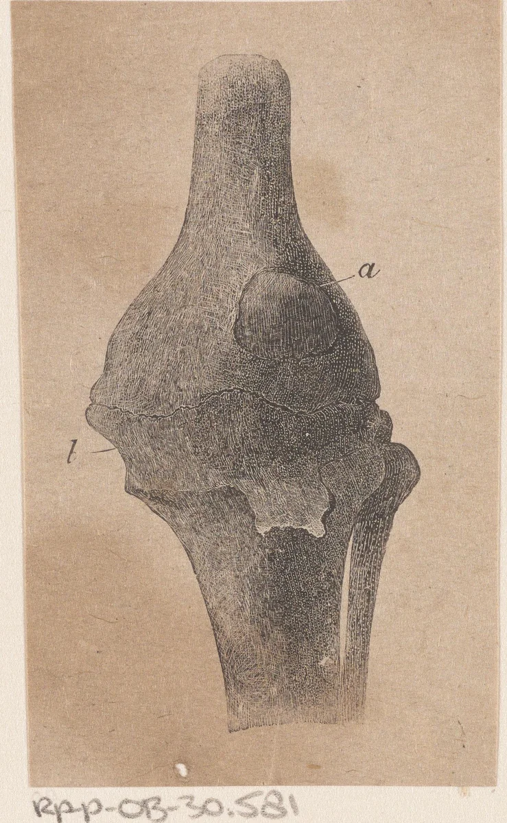 Menselijk bot met een afwijking by Isaac Weissenbruch, print, 1836-1912
