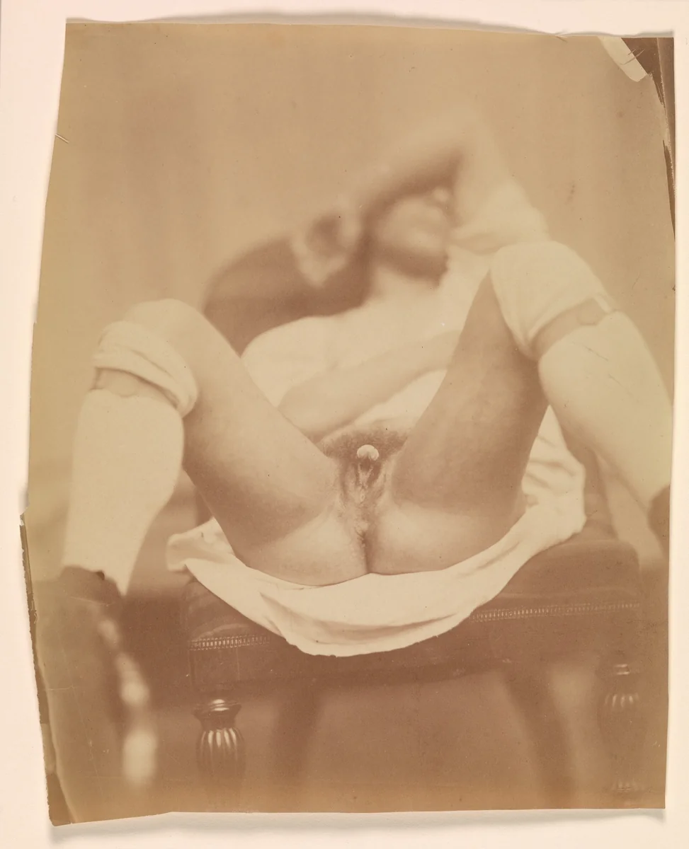 Hermaphrodite by Nadar, photograph, 1860