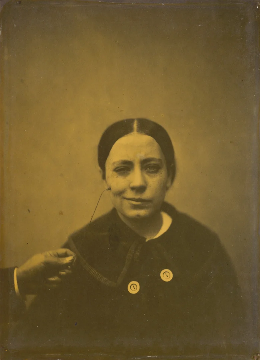 Slight lowering of the angle of the mouth due to depression (left); False laughter (right) by Guillaume-Benjamin-Amant Duchenne, photograph, 1854-1856