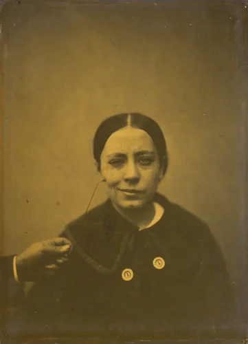 Slight lowering of the angle of the mouth due to depression (left); False laughter (right) by Guillaume-Benjamin-Amant Duchenne, photograph, 1854-1856
