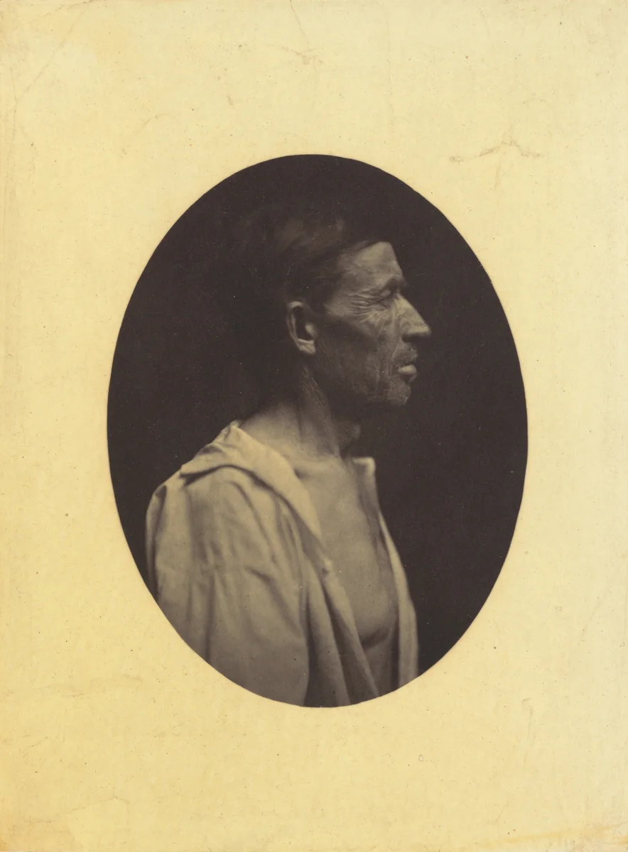 A portrait, seen in profile, of a man 42 years old, stupefied by the abuse of alcohol; his nose is aquiline by Guillaume-Benjamin-Amant Duchenne, photograph, 1854-1856