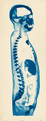 Cryogenic Section of a Cadaver by Harold Mahoney, photograph, 1941-1949