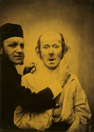 Surprise by Guillaume-Benjamin-Amant Duchenne, photograph, 1854-1855
