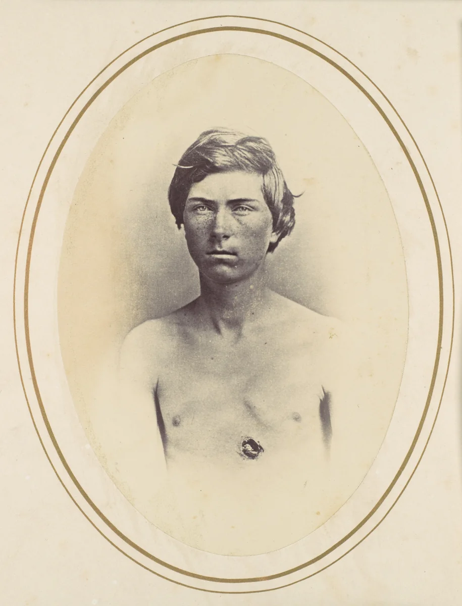 Frederick A. Bentley by Reed Bontecou, photograph, 1865