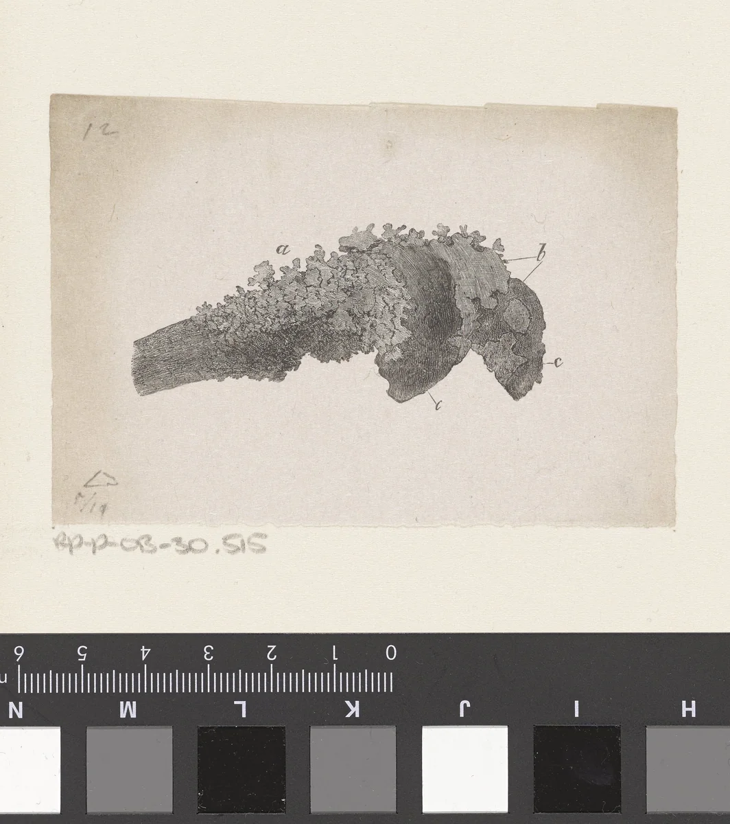 Menselijk bot met een afwijking by Isaac Weissenbruch, print, 1836-1912