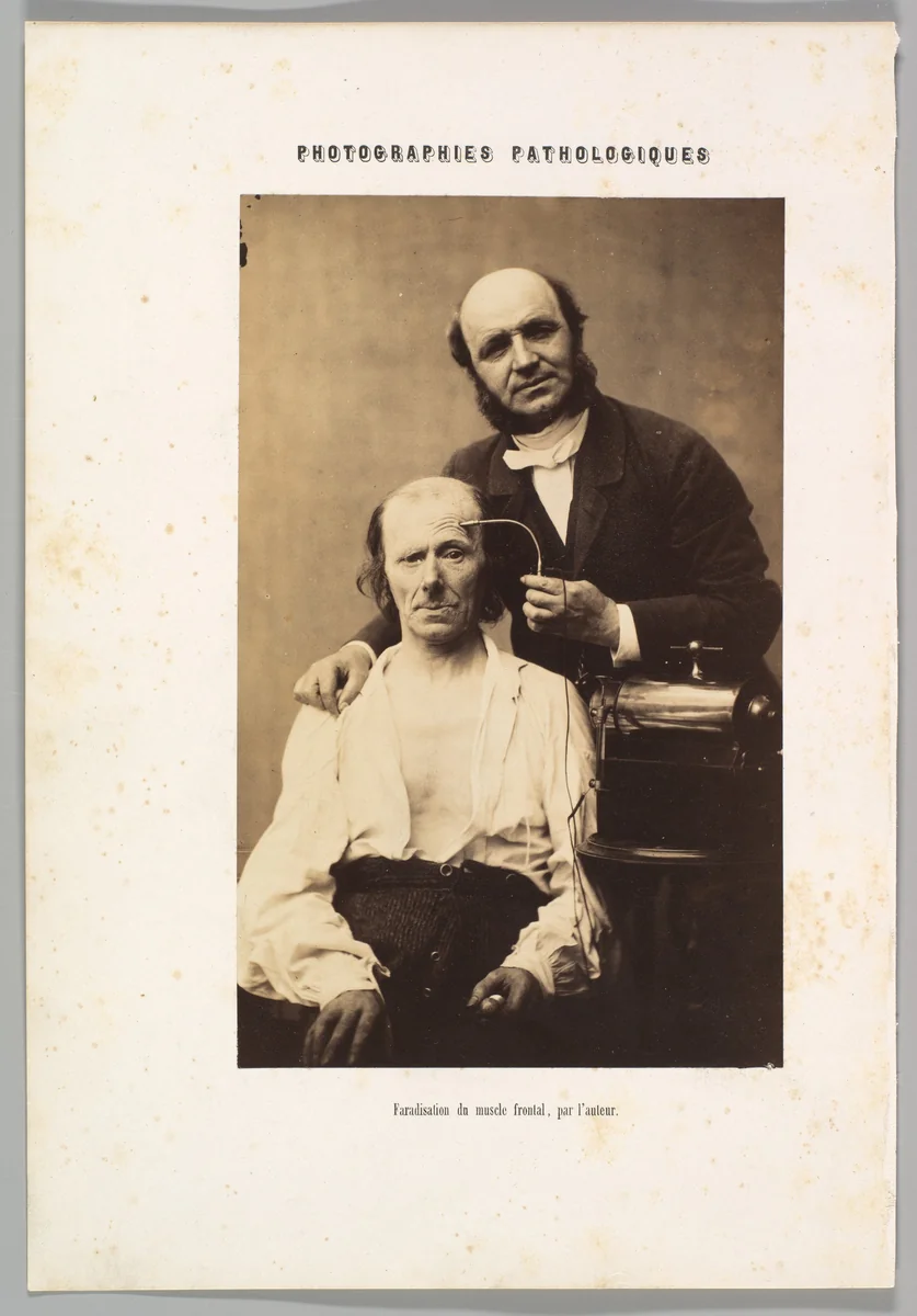 Faradisation du muscle frontal by Guillaume Benjamin Amand Duchenne de Boulogne, photograph, 1854-1856