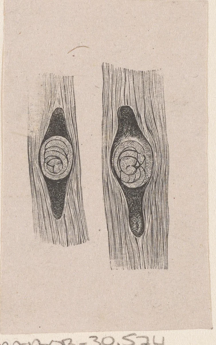 Onderdeel van het menselijk lichaam met een afwijking by Isaac Weissenbruch, print, 1836-1912
