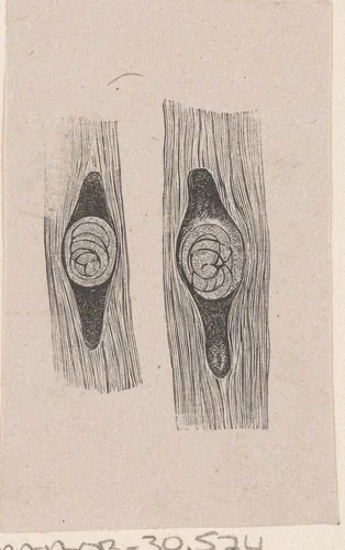 Onderdeel van het menselijk lichaam met een afwijking by Isaac Weissenbruch, print, 1836-1912