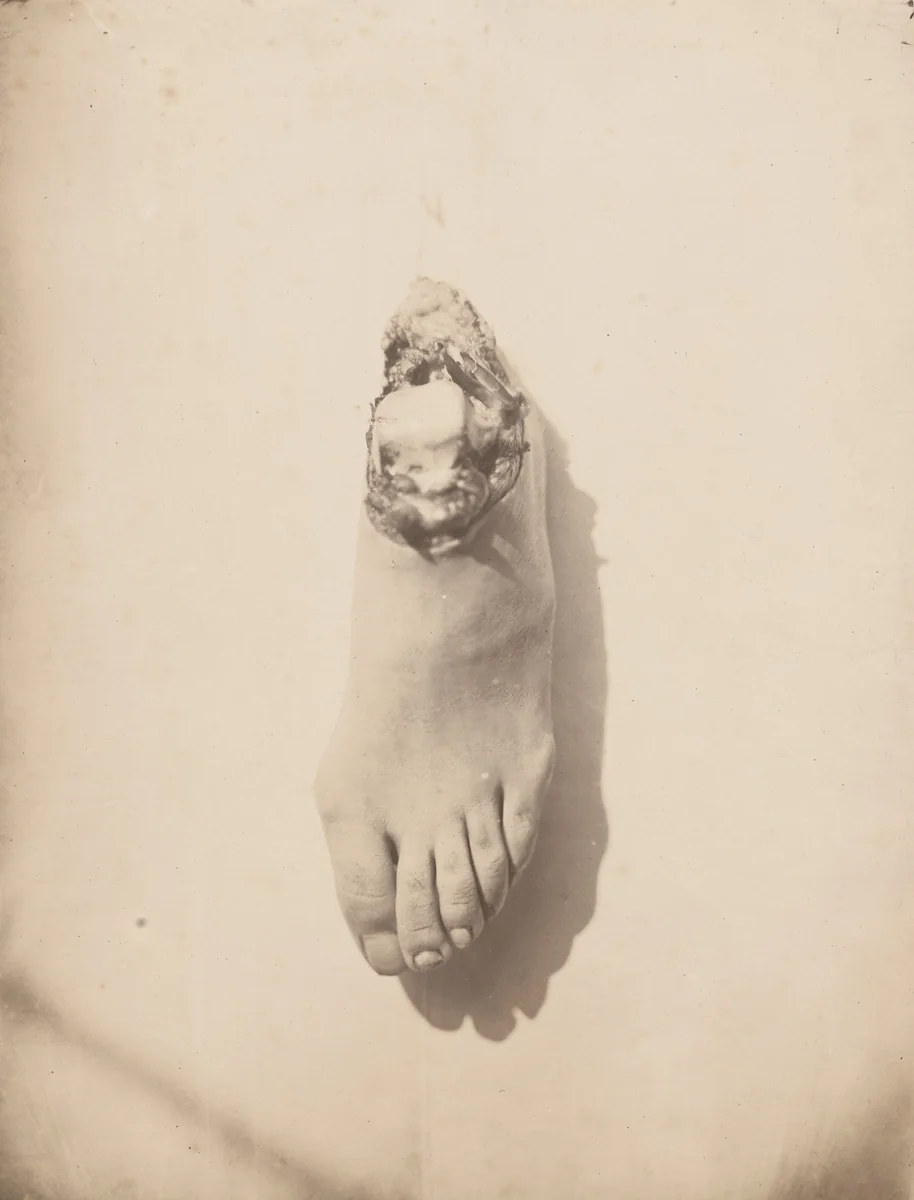 Untitled by Unidentified Photographer, photograph, 1855