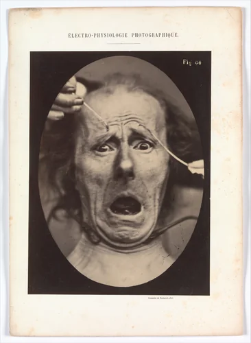 Electro–Physiologie, Figure 64 by Adrien Tournachon, photograph, 1854-1856