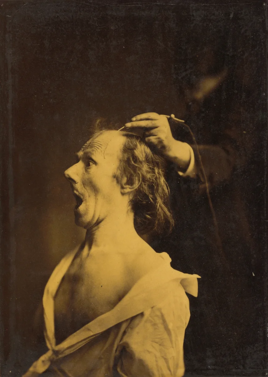 Astonishment, stupefaction, amazement by Guillaume-Benjamin-Amant Duchenne, photograph, 1854-1856