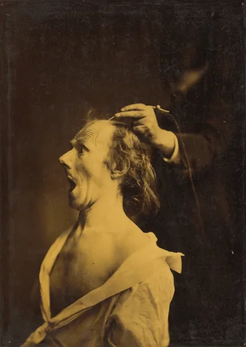 Astonishment, stupefaction, amazement by Guillaume-Benjamin-Amant Duchenne, photograph, 1854-1856