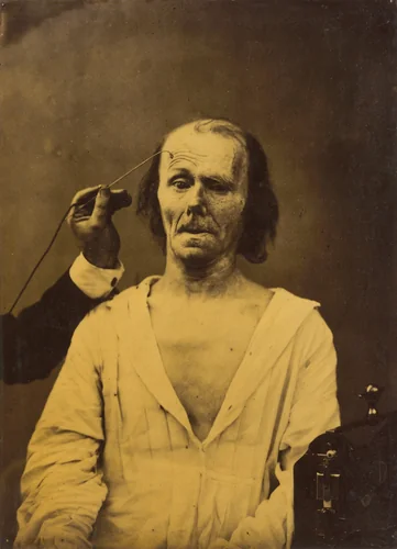 A relaxed face (left); Profound attention (right) by Guillaume-Benjamin-Amant Duchenne, photograph, 1854-1856