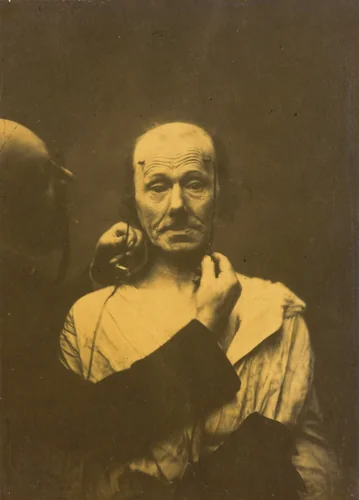 Attention by Guillaume-Benjamin-Amant Duchenne, photograph, 1854-1856