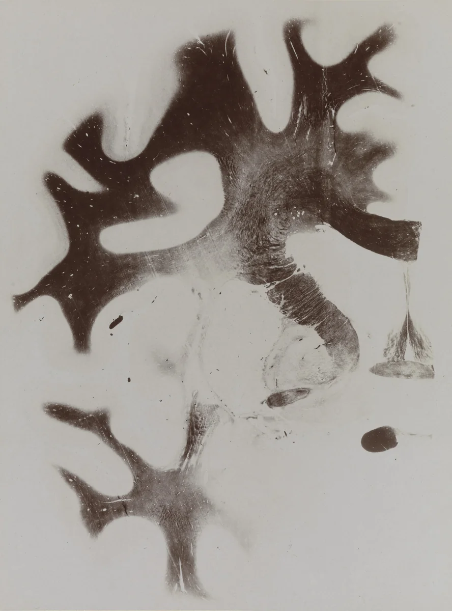 Map of the Brain: Cross-Section I, Frontal Section Plate 11 from an album published by The Psychiatric Clinic of Breslau by Unidentified Photographer, photograph, 1915