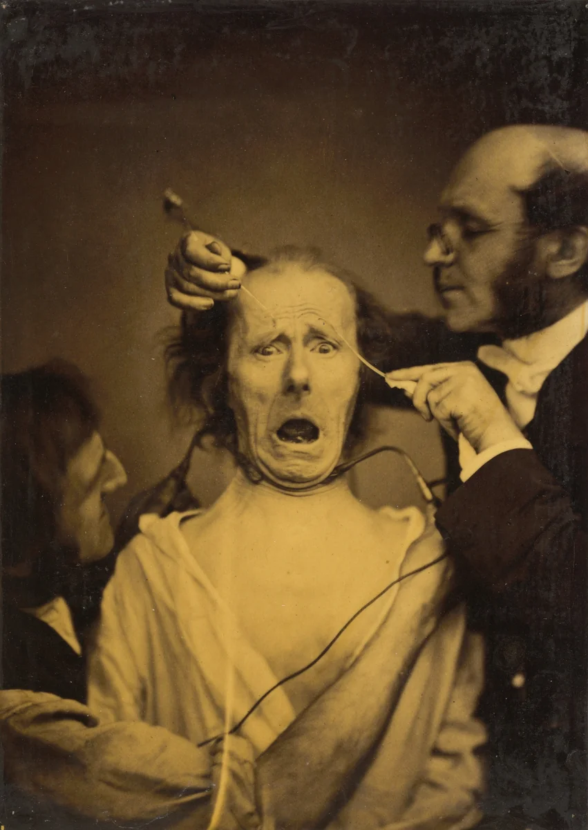 Terror mixed with pain, torture by Guillaume-Benjamin-Amant Duchenne, photograph, 1854-1856