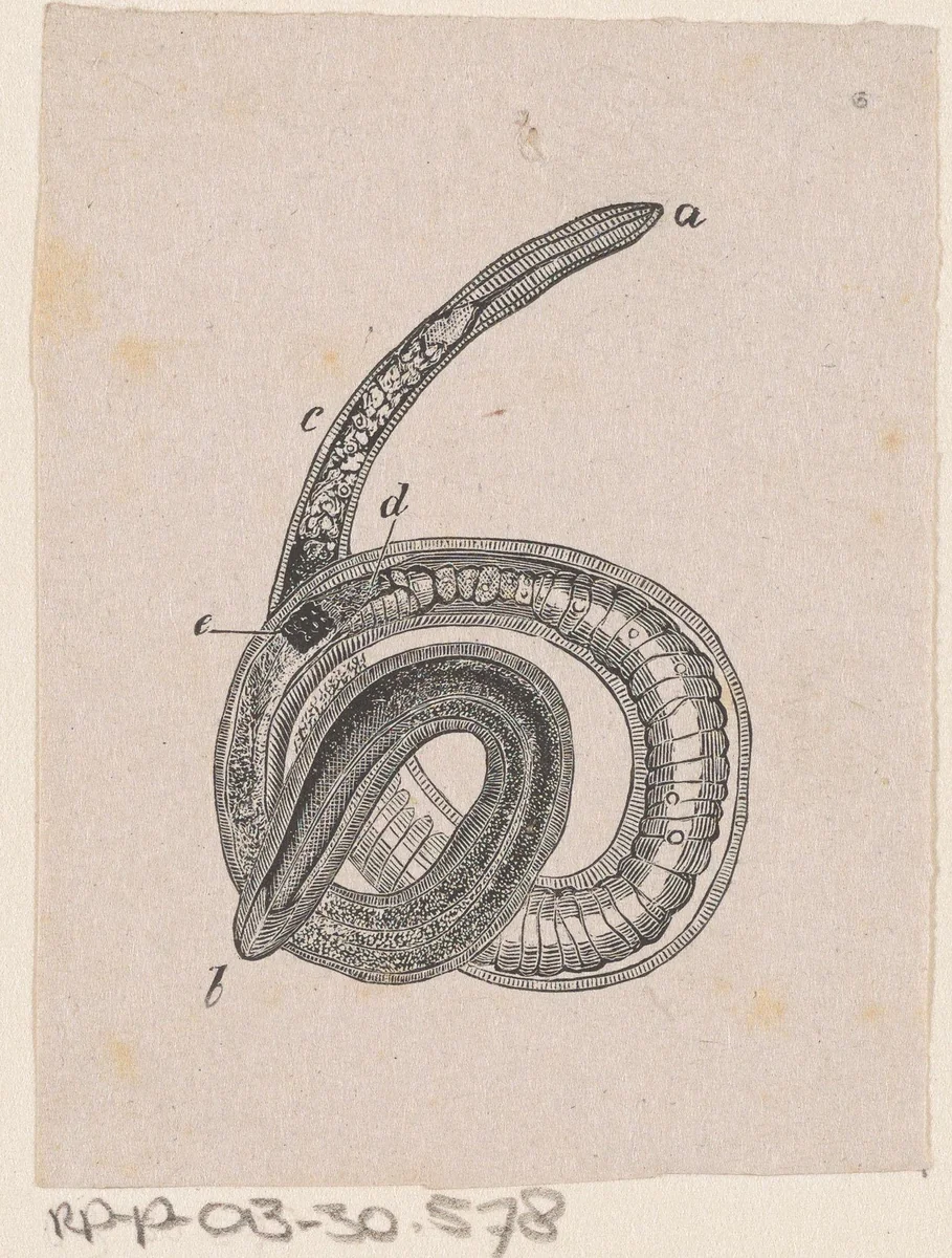 Onderdeel van het menselijk lichaam met een afwijking by Isaac Weissenbruch, print, 1836-1912