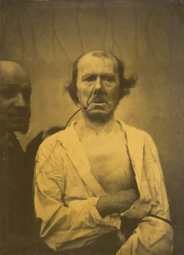 A relaxed expression (left); Disgust (right) by Guillaume-Benjamin-Amant Duchenne, photograph, 1854-1856