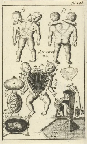 Anatomische afbeelding VI by Jan Luyken, print, 1680-1688