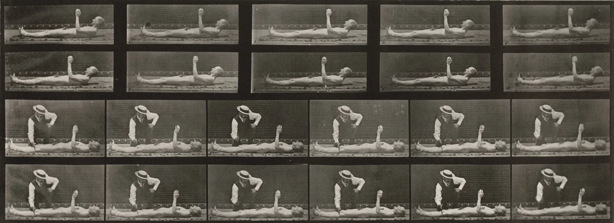 Plate Number 556. Local chorea, lying down by Eadweard Muybridge, photograph, 1887