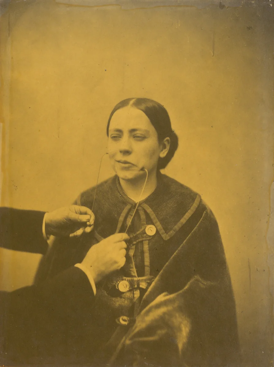 Scornful disgust (left); Scornful laughter (right) by Guillaume-Benjamin-Amant Duchenne, photograph, 1854-1856