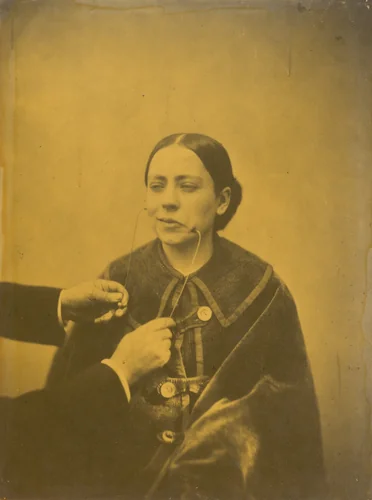 Scornful disgust (left); Scornful laughter (right) by Guillaume-Benjamin-Amant Duchenne, photograph, 1854-1856