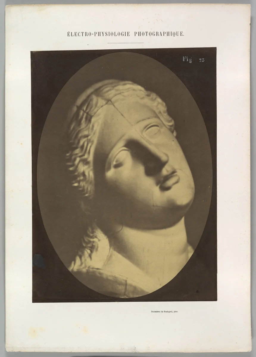 Figure 73: Head of Niobe by Guillaume Benjamin Amand Duchenne de Boulogne, photograph, 1854-1856